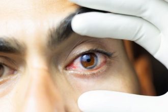 Diwali health hazards: 7 common eye injuries caused due to bursting firecrackers