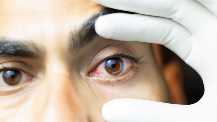 Diwali health hazards: 7 common eye injuries caused due to bursting firecrackers