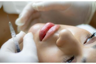 Need a nose job? Surgeon lists the pros and cons of rhinoplasty