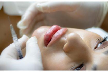 Need a nose job? Surgeon lists the pros and cons of rhinoplasty
