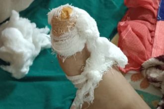 Rat bite or worsening condition? Cancer-stricken boy dies at Jaipur hospital