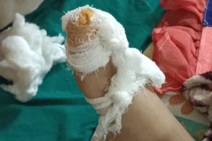 Rat bite or worsening condition? Cancer-stricken boy dies at Jaipur hospital