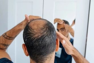 Maharashtra: After hair loss, some villagers in Buldhana’s Shegaon complain of nail problems